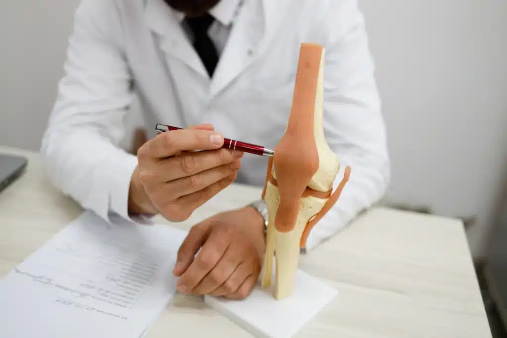 Ortopedico che spiega una patologia del ginocchio su un modello anatomico